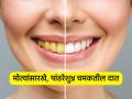 रोज २ वेळा स्वच्छ घासूनही दातांवर पिवळा थर येतो? ५ उपाय -पांढरेशुभ्र राहतील दात - Marathi News | Natural Ways To Whiten Your Teeth : How to whiten your teeth naturally Remedies For Teeth Whitening | Latest sakhi News at Lokmat.com