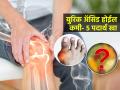 शरीरातलं घातक युरीक अ‍ॅसिड बाहेर फेकतात ५ पदार्थ, रोज न चुकता खा-किडनी होईल डिटॉक्स - Marathi News | Natural Ways to Reduce Uric Acid in the Body : Five effective ways to treat and reduce high uric acid in your body | Latest sakhi News at Lokmat.com