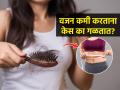 वजन कमी करताना केस का गळतात? केस आणि वजनाचा संबंध काय? केस गळू नये म्हणून.. - Marathi News | Why am I going through hair loss after weight loss? | Latest sakhi News at Lokmat.com