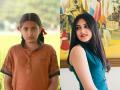 दंगल फेम 'बबिता'चं दुर्मिळ आजाराने निधन, डर्माटोमायोसिटिस नक्की असते काय? महिलांना असतो अधिक त्रास.. - Marathi News | What is Dermatomyositis, rare condition that Dangal actress Suhani Bhatnagar succumbed to? | Latest sakhi News at Lokmat.com