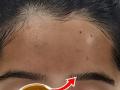 कपाळ काळे पडले? टॅनिंग-मुरुमांच्या डागांनी त्रस्त? दुधात मिसळा २ पिवळ्या गोष्टी-त्वचेवर येईल सोनेरी चमक.. - Marathi News | Homemade Remedies To Remove Forehead Tanning | Latest sakhi News at Lokmat.com