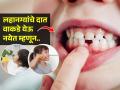 मुलांचे दात वाकडे-तिकडे येतात? दात कोणत्या वयात पडल्याने सरळ येतात? नव्या दातांची कशी काळजी घ्याल? - Marathi News | Teeth development in children | Latest sakhi News at Lokmat.com