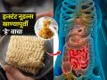 २ मिनिटांत तयार होणारे नूडल्स खाता की दवाखान्यात भरती व्हायची तयारी करताय? वाचा, नक्की होतं काय.. - Marathi News | How Bad are Instant Noodles for Your Health? | Latest sakhi News at Lokmat.com