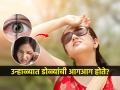 उन्हामुळे डोळे चुरचुरतात, लाल होतात? नेत्रतज्ज्ञ सांगतात '८' घरगुती उपाय, जरा डोळे सांभाळा - Marathi News | 8 Tips to Keep Your Eyes Safe This Summer | Latest sakhi News at Lokmat.com