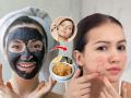 त्वचेवर केलेले 'हे' घरगुती उपाय पडतील महागात, ग्लो येणं तर सोडाच -चेहरा होतो विद्रूप - Marathi News | 5 home remedies that can be harmful for your face and damage your beauty | Latest sakhi News at Lokmat.com