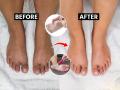 महागडे पेडीक्युअर कशाला? चमचाभर टूथपेस्टनेही पाय होतील स्वच्छ - दिसतील सुंदर - Marathi News | Get fairer feet with this DIY feet whitening pedicure | Latest sakhi News at Lokmat.com