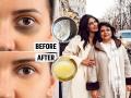 डार्क सर्कल्स कमी करण्यासाठी प्रियांका चोप्राची आई सांगतेय घरगुती उपाय, ८ दिवसांतच दिसेल फरक - Marathi News | priyanka chopras mother madhu chopra suggest home remedies for reducing dark circles, how to get rid of dark circles? | Latest sakhi News at Lokmat.com