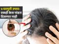 डोक्यावरचे पांढरे केस खूपच चमकतात? डाय न लावता करा ५ घरगुती उपाय; काळेभोर दिसतील केस - Marathi News | Teenage Home Remedies For White Hairs : Natural Home Remedies For Grey Hairs | Latest sakhi News at Lokmat.com