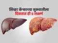 लिव्हर कॅन्सरचे संकेत देतात साधी वाटणारी ५ लक्षणं; वेळीच ओळखा हे बदल- पाहा काळजी काय घ्यायची - Marathi News | Diseases Conditions These 5 Symptoms Appers in The Body in Early Stage Of Liver Cancer | Latest sakhi News at Lokmat.com