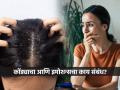 इमोशनल व्यक्तींच्या डोक्यात खूप कोंडा होतो! पाहा केसांत कोंडा होण्याची ५ मुख्य कारणं - Marathi News | Can extreme emotions cause DANDRUFF?, 5 main reasons for dandruff, how to get rid of dandruff | Latest sakhi News at Lokmat.com
