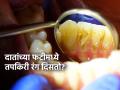 दिवसातून दोनदा ब्रश करूनही दातांचा पिवळेपणा जात नाही- तोंडाला दुर्गंध येतो? बघा कुठे चुकतं... - Marathi News | how to prevent cavities and plaque buildup. How can I get rid of my brown teeth? How to stop mouth smell? major reason for bad breath | Latest sakhi News at Lokmat.com
