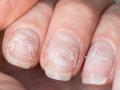 नेल आर्ट-मॅनिक्युअर करण्याची गरज नाही, सुंदर नखांसाठी फक्त खाण्यात ‘हे’ सोपे बदल करा... - Marathi News | Diet & lifestyle changes for stronger nails What To Eat for Healthy, Beautiful Nails | Latest sakhi News at Lokmat.com