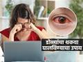 स्क्रिनवर सतत काम करून डोळ्यांवर ताण येतो? २०-२०-२० चा फॉर्म्युला वापरा- डोळ्यांना आराम मिळेल - Marathi News | The 20-20-20 Rule of Eye Care, how to give relaxation to eyes, best eye exercise | Latest sakhi Photos at Lokmat.com