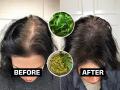 डोक्यावर केस विरळ, टक्कलच जास्त दिसतं? ५ रुपयांच्या कढीपत्त्याचा खास उपाय- केस होतील दाट - Marathi News | Hair Care Tips : How To Grow Hairs Naturally Hair Growth Tips | Latest sakhi News at Lokmat.com