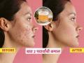 किचनमधले २ पदार्थ नियमित वापरा; डार्क स्पॉट्स, पिगमेंटेशन गायब- चेहऱ्यावर येईल नॅचरल ग्लो  - Marathi News | 2 ingredients in kitchen for radiant glowing skin, how to get flawless glass skin like korean girls, best home remedies for reducing pigmentation | Latest sakhi News at Lokmat.com