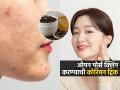 ओपन पोर्स वेळीच करा स्वच्छ ! नाहीतर होतील स्किन प्रॉब्लेम्स, ओपन पोर्स क्लिन करण्याची कोरियन ट्रिक... - Marathi News | how to use a honey &  coffee face mask to treat open pore How to Treat Large Facial Open Pores Simple Way to Get Rid of Large Open Pores | Latest sakhi News at Lokmat.com