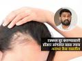 टक्कल पडलं-वय जास्त दिसतं? आयुर्वेदीक डॉक्टर सांगतात १ उपाय करा, भरभर वाढतील केस - Marathi News | Ayurvedic Doctor Oil Recipe To Prevent Hair Fall in One Month In 30 Days | Latest sakhi News at Lokmat.com