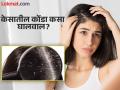 केसातील कोंडा कसा घालवाल? शॅम्पू, तेल किंवा साबण सोडून एकदा करा हे उपाय - Marathi News | How to get rid of dandruff? Do this remedy once without shampoo, oil or soap | Latest chandrapur News at Lokmat.com