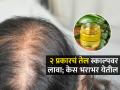 ऐन तारुण्यात केस गळाले-टक्कल दिसू लागलं? 'या' २ प्रकारचे तेल मिसळून लावा, केस वाढतील परत - Marathi News | How To Prevent Hair Loss And Improve Bald Patches At Home By Content Creator Somya Bisla | Latest sakhi News at Lokmat.com