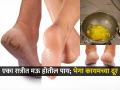 पायांना भेगा पडल्यात, रक्तही निघतं? ५ उपाय , मलम न लावता पाय मऊ-कोमल राहतील - Marathi News | Crack heels solution : Crack heels Home Remedies How To Get Rid Of Crack Heels | Latest sakhi News at Lokmat.com
