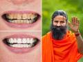 दातांवर पिवळा-जाड थर दिसतो? रामदेव बाबा सांगतात १ आयुर्वेदीक उपाय, पांढरेशुभ्र चमकतील दात - Marathi News | Baba Ramdev Told A Simple Ayurvedic Remedy To Get Rid Of Yellow Teeth Toothache Bleeding Gums | Latest sakhi News at Lokmat.com