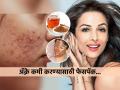 चेहऱ्यावरची पुरळ कमी करण्यासाठी मलायका अरोराचा हा खास ‘देसी’ उपाय, ॲक्ने होईल कमी लवकर - Marathi News | Malaika Arora Uses This Home Remedy To Get Rid Of Acne & Pimples Homemade Face Packs For Pimples and Acne Prone Skin Acne-Fighting Face Masks To Try At Home | Latest sakhi News at Lokmat.com