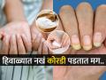 हिवाळ्यात नखं वारंवार तुटतात, त्वचा कोरडी पडते? ५ टिप्स, नखं तुटणार नाहीत आणि... - Marathi News | 5 tips to take perfect care of your nails in winter How to avoid dry hands damaged nails this Winter Nail Care Secrets for the Winter Months | Latest sakhi News at Lokmat.com