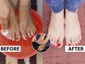 तळपाय खूपच खरखरीत होऊन काळे पडले? घरीच करा पेडिक्युअर- पाय होतील मऊ-दिसतील सुंदर - Marathi News | 5 step pedicure at home, Winter Foot Care Tips, how to remove tanning and dead skin from feet, how to do pedicure at home | Latest sakhi Photos at Lokmat.com
