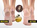 भेगा पडल्यानं टाचा दुखतात? शहनाज़ हुसैन सांगतात एक जादुई तेल, टाचा दुखणं थांबेल - Marathi News | Winter Feet Care Tips To Make Them Beautiful By Beauty Expert Shahnaz Husain Follow Shahnaz Husain's Guide To Heal your heels during winters | Latest sakhi News at Lokmat.com