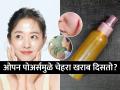 कमी वयातच चेहऱ्यावर सुरकुत्या- पिगमेंटेशन? 'हा' जादुई स्प्रे मारा.. वय वाढलं तरी तरुणच दिसाल - Marathi News | how to get rid of pigmentation, open pores and wrinkles on skin? best home remedies for young glowing skin | Latest sakhi Photos at Lokmat.com