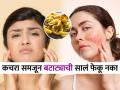 चेहऱ्यावर पिगमेंटेशन, बारीक सुरकुत्या दिसू लागल्या? बटाट्याची सालं 'या' पद्धतीने वापरा, त्वचा तरुण दिसेल - Marathi News | use of potato peel for young glowing skin, skin care tips using potato peel, potato peel face pack for reducing pigmentation | Latest sakhi Photos at Lokmat.com