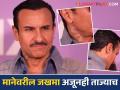 सैफ अली खानच्या मानेवर दिसल्या चाकू हल्ल्याच्या जखमा, फोटो आले समोर - Marathi News | Saif Ali Khan Makes First Public Appearance After Stabbing Incident Spotted With Neck Scar In Netflix Release Jewel Thief Trailer Launch | Latest filmy News at Lokmat.com