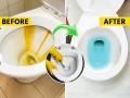 कितीही घासलं तरी टॉयलेट पिवळंच दिसतं? ३ सोपे उपाय, टॉयलेट चमकेल स्वच्छ-दुर्गंधी गायब - Marathi News | how to get rid of yellow stains from toilet seat, best home remedies to clean toilet seat, how to remove yellowish stains from toilet seat | Latest sakhi News at Lokmat.com