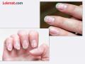 नखांवर पांढरे डाग, वेडीवाकडी नखं; कारणं माहीत आहेत का? - Marathi News | White spots on nails, crooked nails; do you know the reasons? | Latest bhandara News at Lokmat.com
