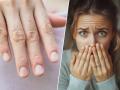 तुम्हाला डायबिटिस आहे की थायरॉईड, तुमची नखं सांगतात चटकन! नखांना नेलपेंट लावण्यापूर्वी ‘हे’ वाचा.. - Marathi News | how your nails reflect your health diabetes thyroid Signs of poor health in your nails | Latest sakhi News at Lokmat.com