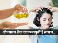 'हा' त्रास असणाऱ्या व्यक्तींनी डोक्याला तेल लावणे टाळावे! बघा तुम्ही तर त्यात नाही ना? - Marathi News | these people must avoid applying oil to head, people with 2 diseases should not apply oil to head  | Latest sakhi News at Lokmat.com