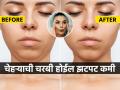 चेहरा भप्प जाडजूड दिसतो? चेहऱ्यावरची चरबी घटवण्याचे पाहा ६ सोपे उपाय, डबल चीन गायब - Marathi News | Does your face look too fat? See 6 easy ways to reduce facial fat | Latest sakhi Photos at Lokmat.com