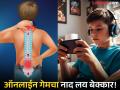 रोज १२ तास मोबाईलवर गेम खेळायचा मुलगा; पाठीच्या कण्याचे वाजले तीन तेरा, परिस्थिती गंभीर - Marathi News | delhi teenager boy having 12 hour per day gaming addiction leads to bent spine partial paralysis | Latest national News at Lokmat.com