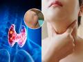 बहुसंख्य महिलांना छळतोय थायरॉईड, पाहा कशी करायची तपासणी आणि प्रत्यकीने कशी घ्यायची काळजी.. - Marathi News | Thyroid is a problem for most women, see how to get tested and how to take care of yourself | Latest sakhi News at Lokmat.com