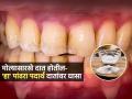 दात कायम पिवळे दिसतात? झोपण्याआधी चिमूटभर हा पदार्थ दातांवर घासा; सकाळी चमकतील दात - Marathi News | What Is best Solution For Whiten Your Teeth Ayurvedic doctor Shares Home Remedies | Latest sakhi News at Lokmat.com