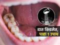 Tips To Get Rid Of Cavity : दातांना आतून खड्डे पडलेत-कीड लागली? डॉक्टर सांगतात १ खास उपाय, दातदुखी होते कमी - Marathi News | Famous Detist Dr Ellie Phillips Share 5 Effective Tips To Get Rid Of Cavity At Home | Latest sakhi News at Lokmat.com