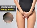 मांड्यांचा आतला भाग खूपच काळा दिसतो? डॉक्टर सांगतात १ उपाय, त्वचा चमकेल, काळेपणा दूर - Marathi News | How To Remove Black Spots In a Private Area Ask Your Doctor What To Apply On Your Private Parts | Latest sakhi News at Lokmat.com