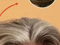 Grey Hair Remedies : केस पिकलेत? मेंहेदी- डाय लावणं विसरा! पाहा घरगुती तेल, ७ दिवसात केस काळे - Marathi News | Grey Hairs Remedies : Doctor Saleem Zaidi Ayurvedic Oil Which Make White Hairs Black From Roots | Latest sakhi News at Lokmat.com