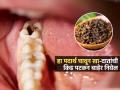 दातांना कीड लागली-मध्येच दाढ दुखते? किचनमधला 'हा' पदार्थ चावून खा, दातदुखी होते कमी - Marathi News | How To Get Rid From Cavity Cloves And Garlic Best Medicine For Teeth Cavity | Latest sakhi News at Lokmat.com