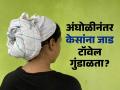 केस धुतल्यानंतर जाड टॉवेलं गुंडाळून ठेवता? डॉक्टर सांगतात या सवयीमुळे पडू शकतं टक्कल - Marathi News | Do you wrap your hair in a thick towel after washing it this habit can cause baldness | Latest sakhi Photos at Lokmat.com