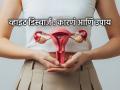 Menstrual Health: अंगावर पांढरे पाणी जाते, सतत ओल आणि खाज? ५ घरगुती उपाय, त्रास अंगावर काढू नका... - Marathi News | Menstrual Health: White discharge on the body, constant wetness and itching? 5 home remedies, don't take the trouble out on yourself... | Latest sakhi News at Lokmat.com