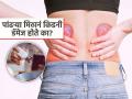 रोज खातो त्या पांढऱ्या मिठानं किडनी डॅमेज होते का? डॉक्टरांनी दिलेला सल्ला वाचा आणि धोका टाळा... - Marathi News | Does the white salt we eat every day cause kidney damage? Read the doctor's advice and avoid the risk... | Latest sakhi News at Lokmat.com