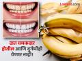 दातांवर जमा पिवळा थर झटक्यात होईल दूर, केळीच्या सालीच 'असा' करा वापर! - Marathi News | Banana peel for white teeth, yellow teeth home remedies | Latest beauty News at Lokmat.com
