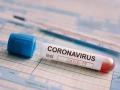 CoronaVirus in Washim : आणखी चौघांचा मृत्यू; ७० पॉझिटिव्ह ! - Marathi News | CoronaVirus in Washim: Four more die; 70 Positive! | Latest vashim News at Lokmat.com