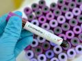 CoronaVirus पनवेलमध्ये आढळला आणखी एक कोरोना पॉझिटिव्ह रुग्ण  - Marathi News | coronaVirusAnother positive patient found in Panvel hrb | Latest navi-mumbai News at Lokmat.com